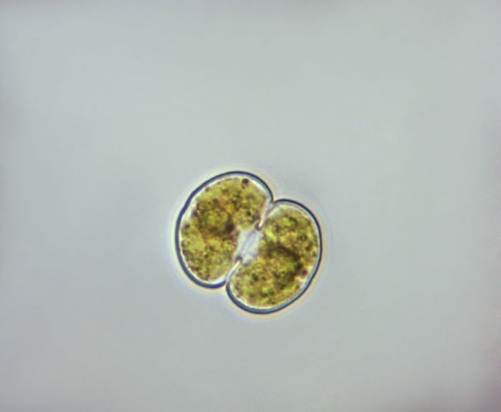 Cosmarium sp.